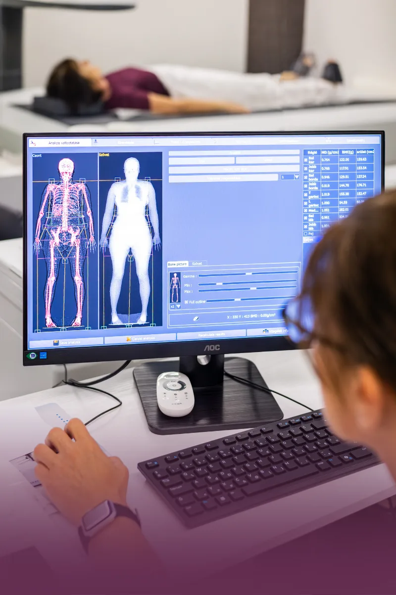 DEXA