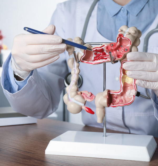 Vastagbél betegség EndoKapszula