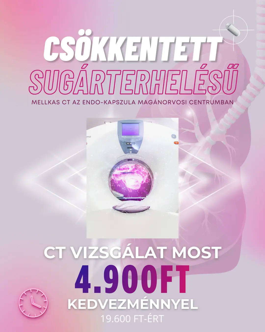 CT Akció