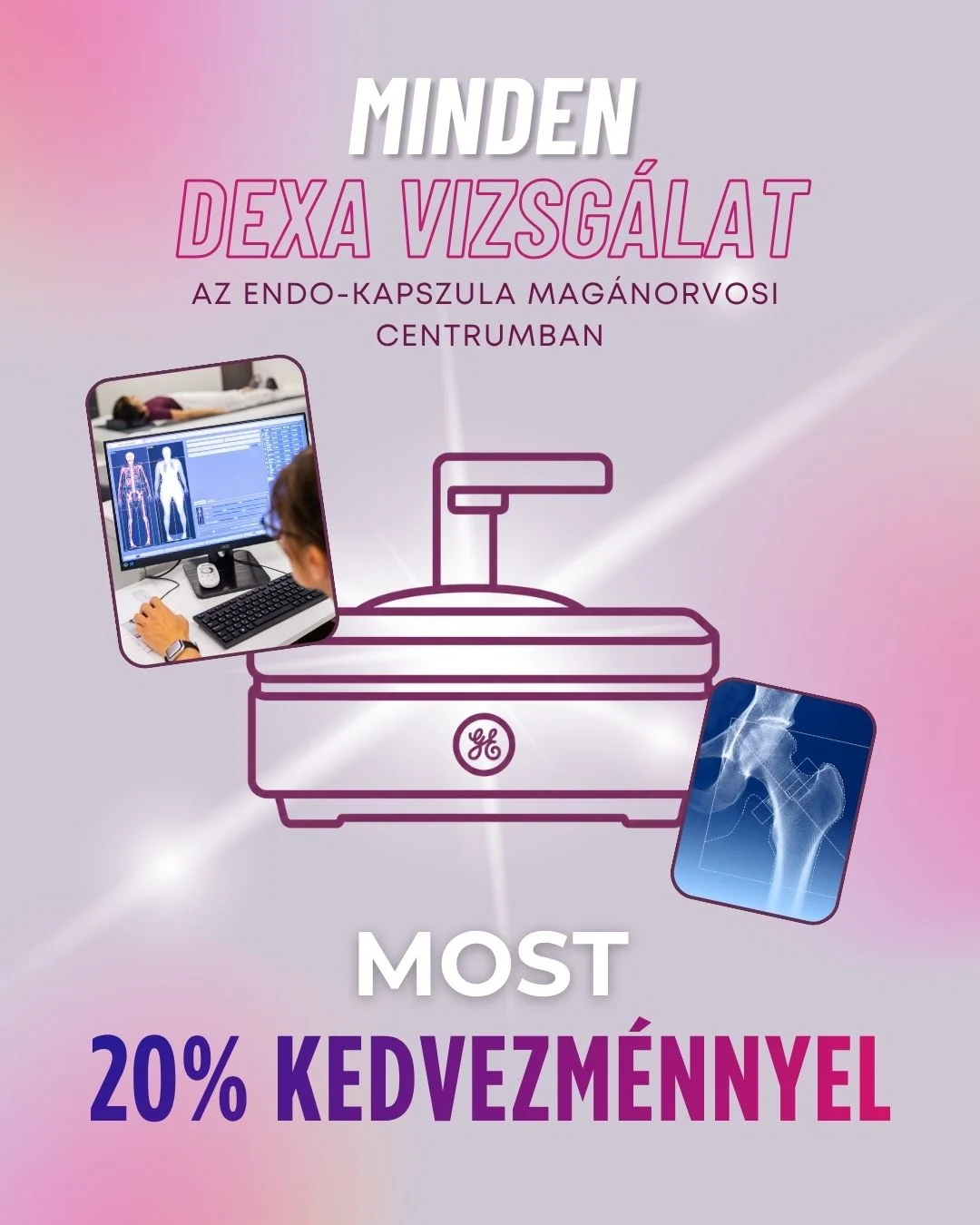 Konzi DEXA